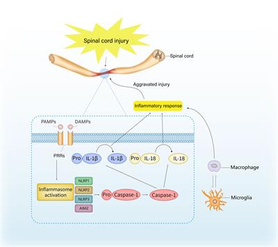 An emerging role of inflammasomes in spinal cord injury and spinal cord tumor